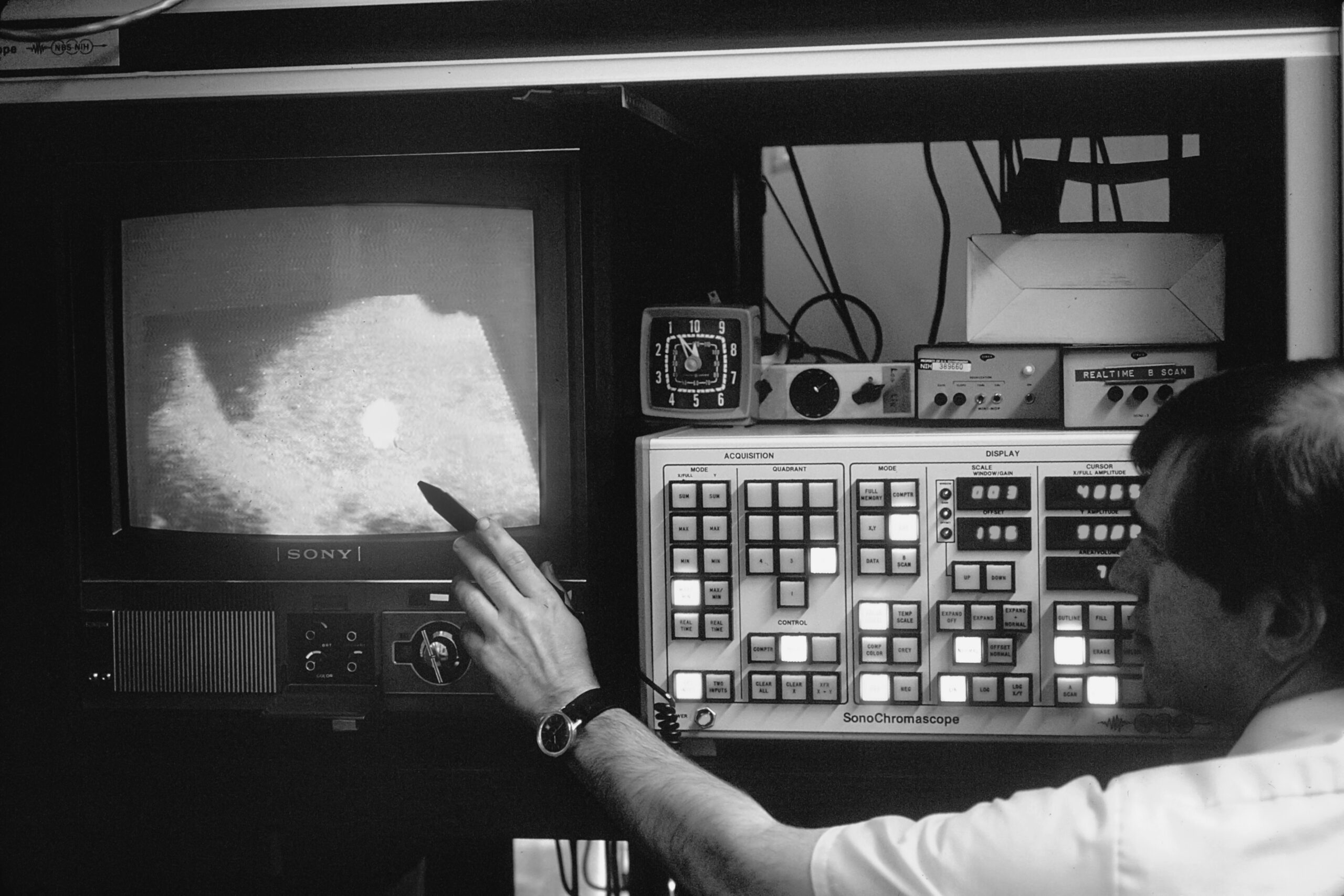 These Are the Things to Know Before Getting an Ultrasound