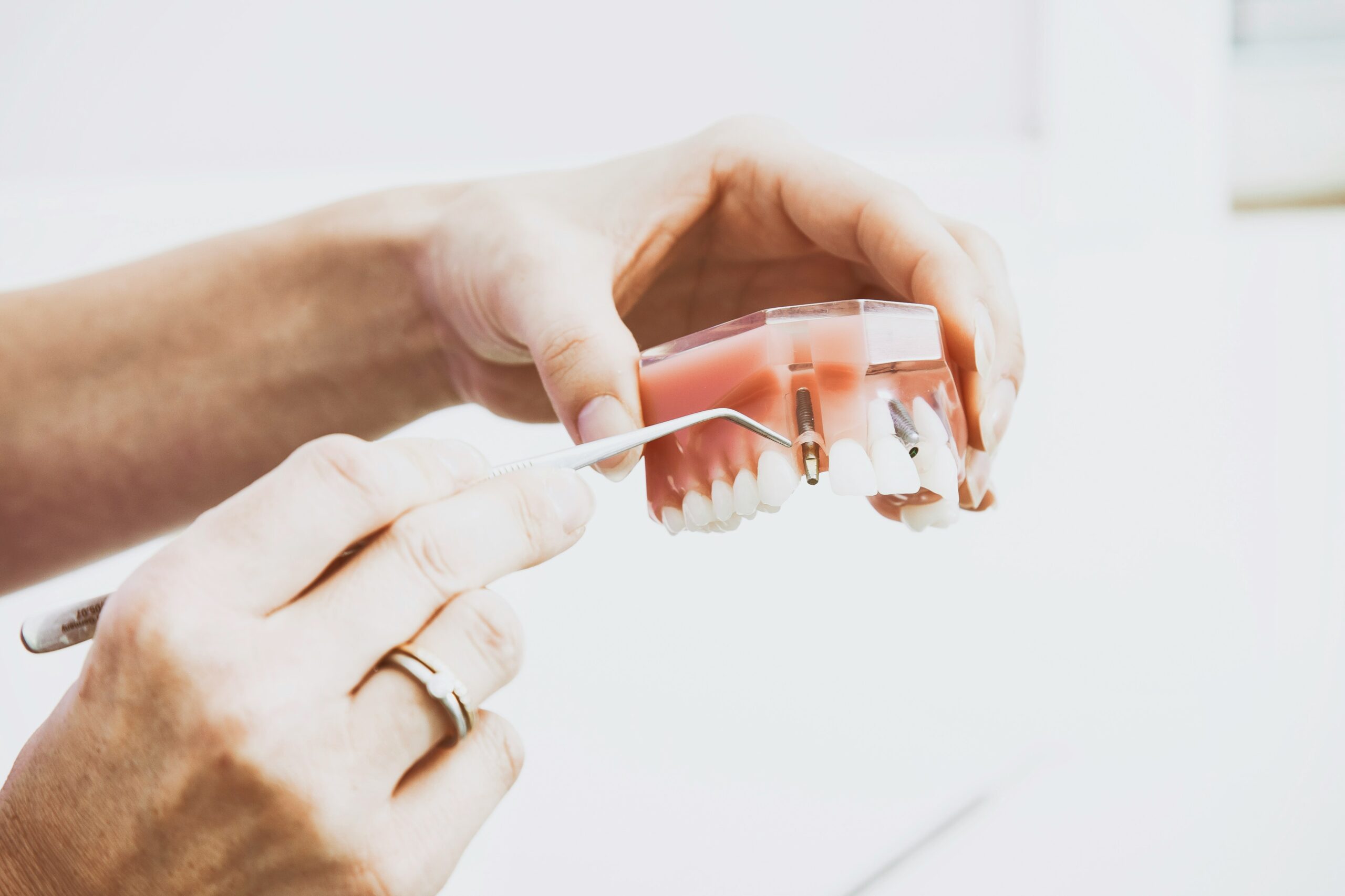 How to choose the right smile restoration