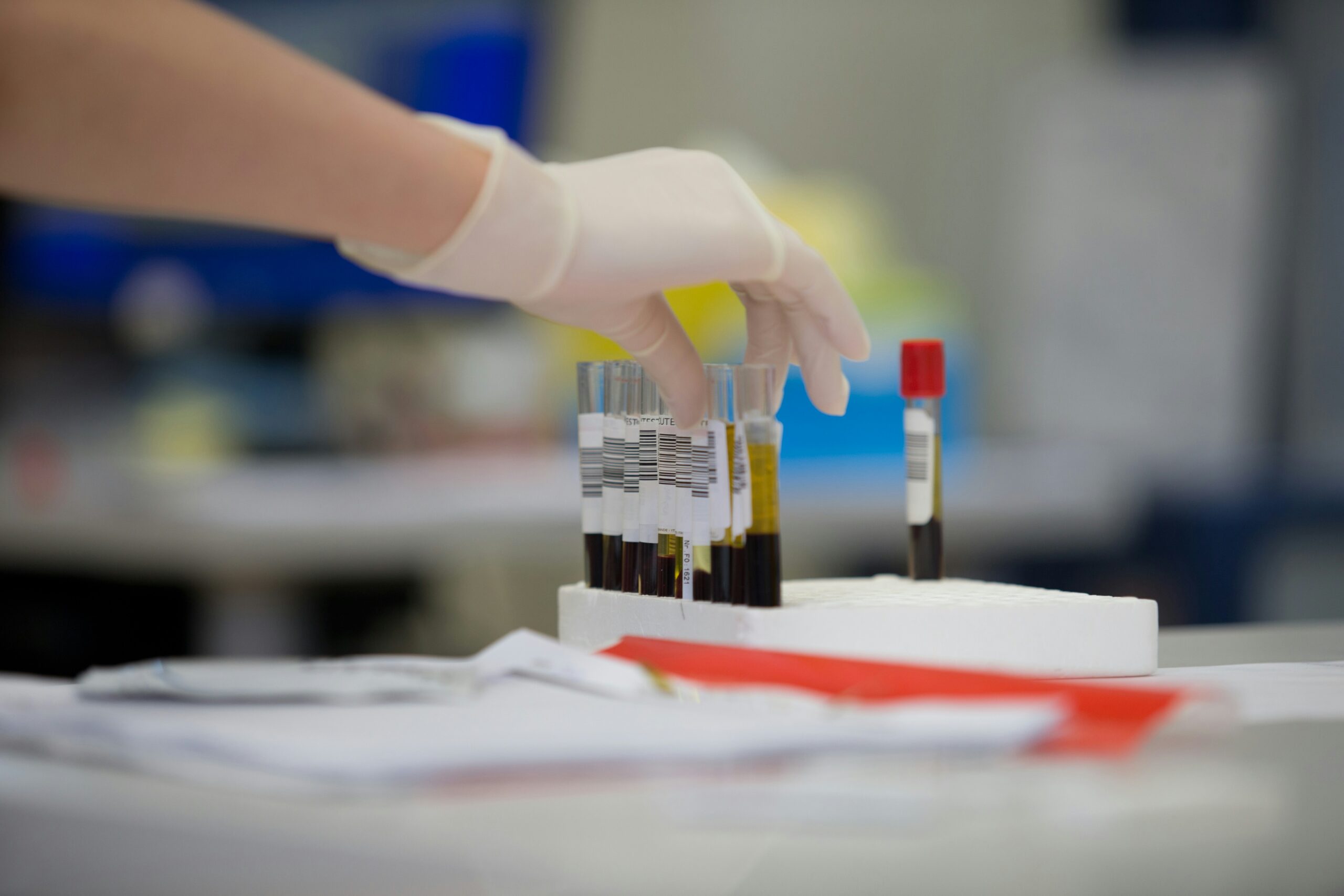 The Life-Changing Potential of Cord Blood Stem Cells: A Mother’s Guide to a Healthier Future.