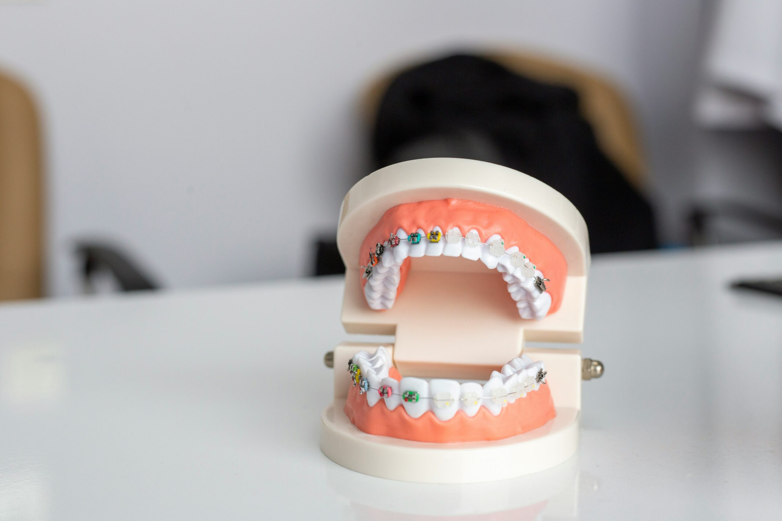 Protruding Teeth: What Are the Causes?
