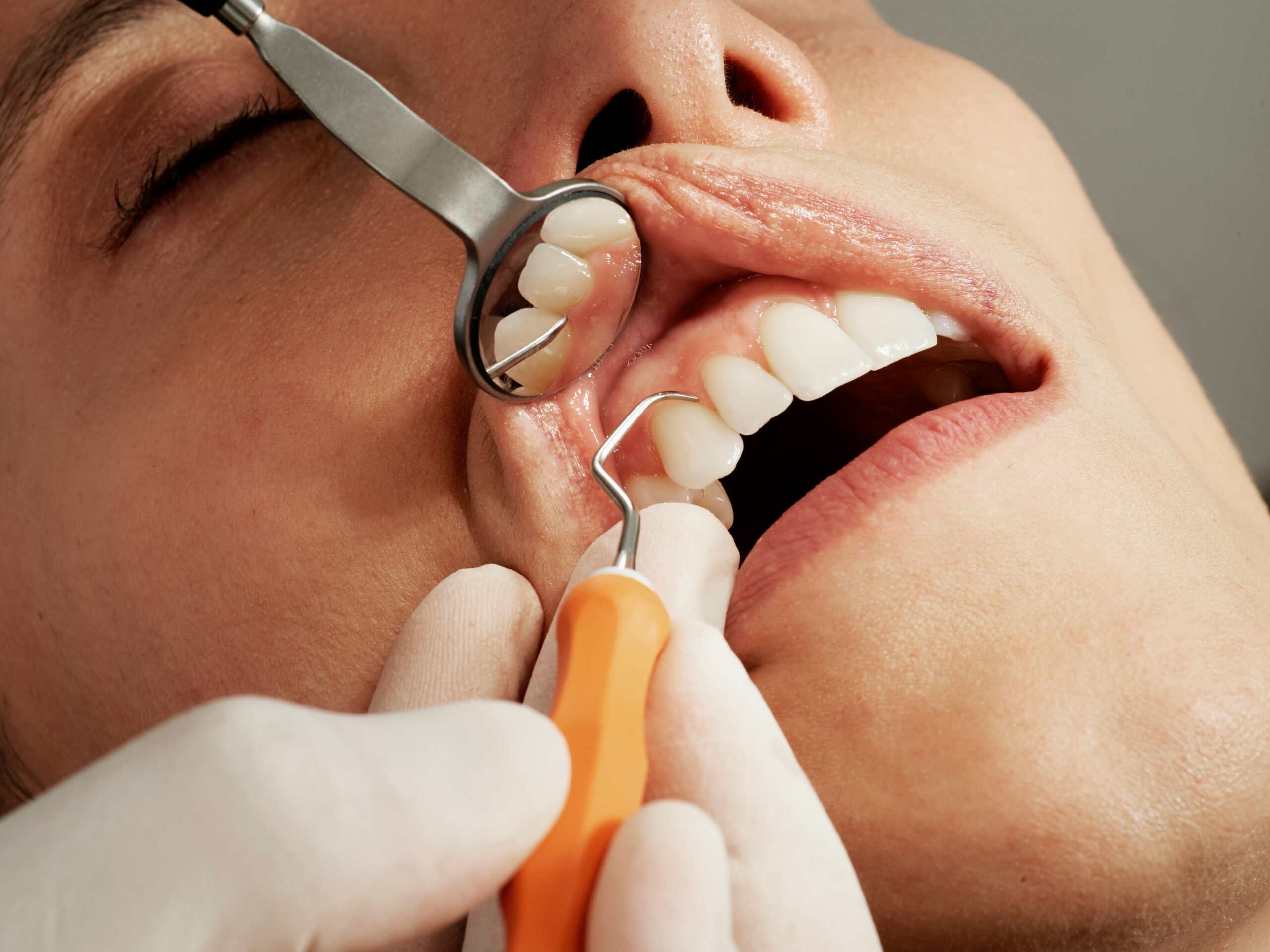 Why dental check-ups matter for parents too, even when we’re putting everyone else first