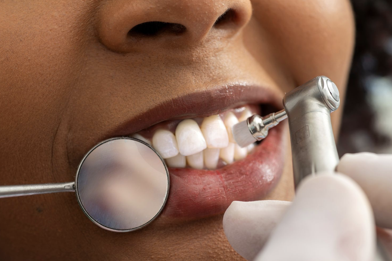 Professional Dental Cleaning: What To Expect And Why It Matters