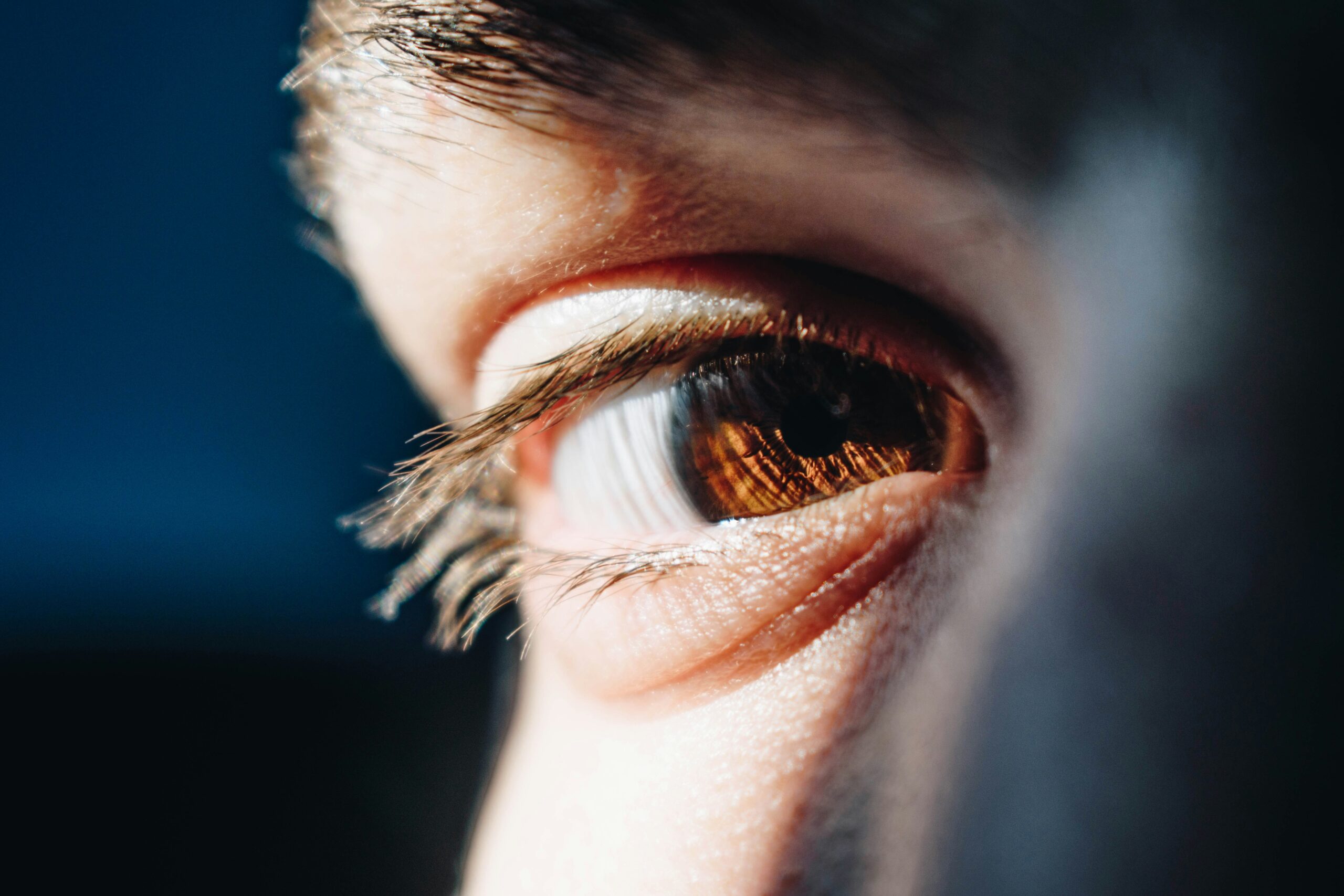 5 Signs You May Need Lower Blepharoplasty for Under-Eye Bags