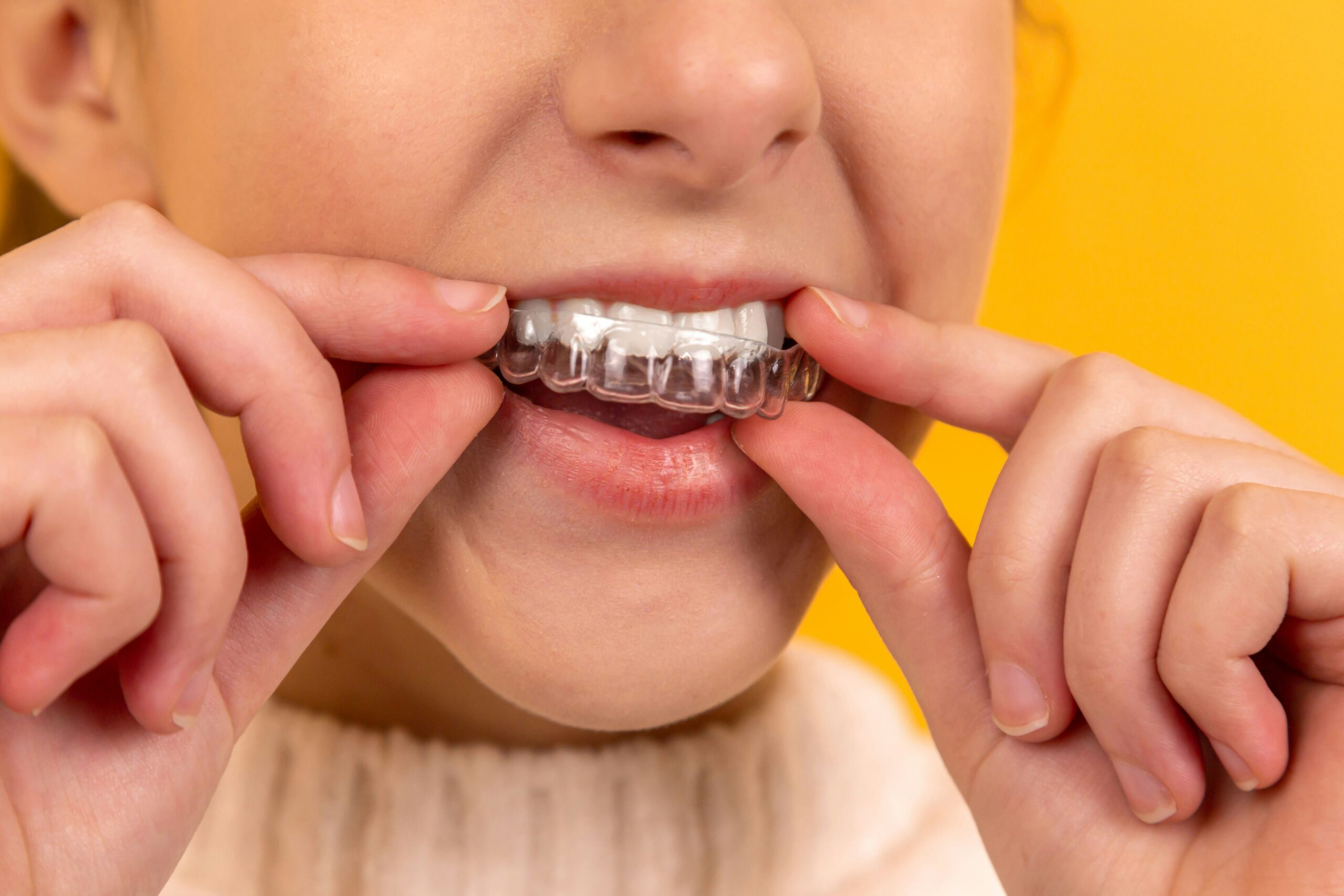 A Day in the Life with Clear Aligners: What to Expect